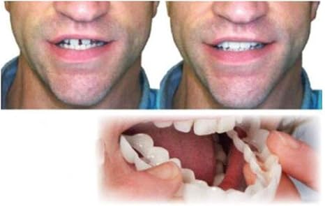 Snap On Smile Instant Teeth Whitening Cosmetic Teeth Dental Denture Care New Size (Upper and Lower)