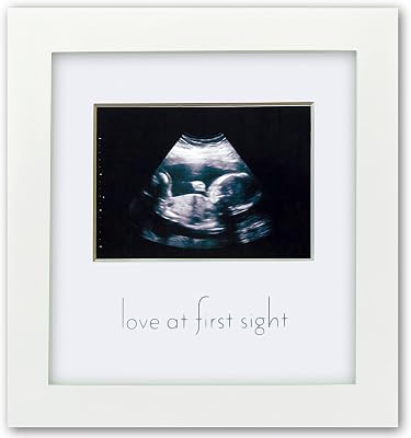 Green Pollywog Sonogram Photo Display | White Ultrasound Frame | Pregnancy Gift for First-Time Moms, Parents & Grandparents | Nursery Decor