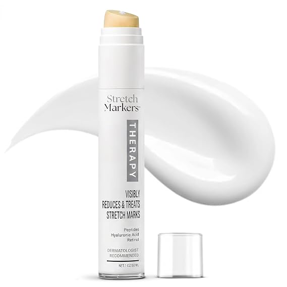 Stretch Marks Cream Hydrates Skin, Supports Elasticity & Collagen,1fl oz