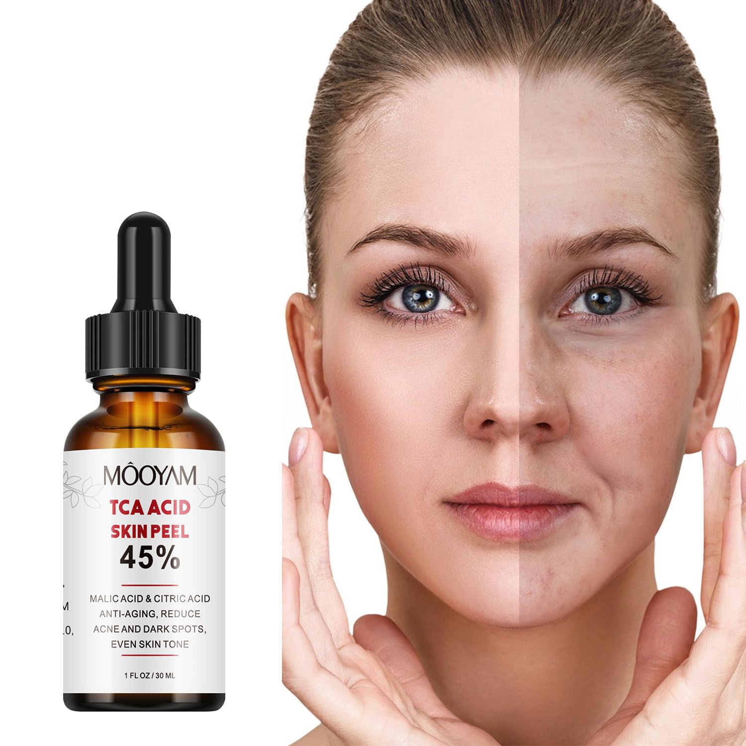 Facial Peeling Serum with 45% Citric Acid, Chemical Exfoliant for Face Exfoliating, Peeling Solution, Face Chemical Peel At Home for Acne Dark Spots Wrinkles, Beauty Skin Care